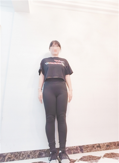 高女士減脂前后對比。