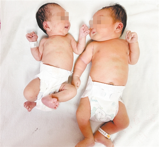 “重量級”寶寶比常見新生兒體型大了很多。